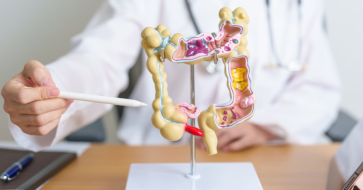 10 Natural Remedies to Cleanse and Support Colon Health