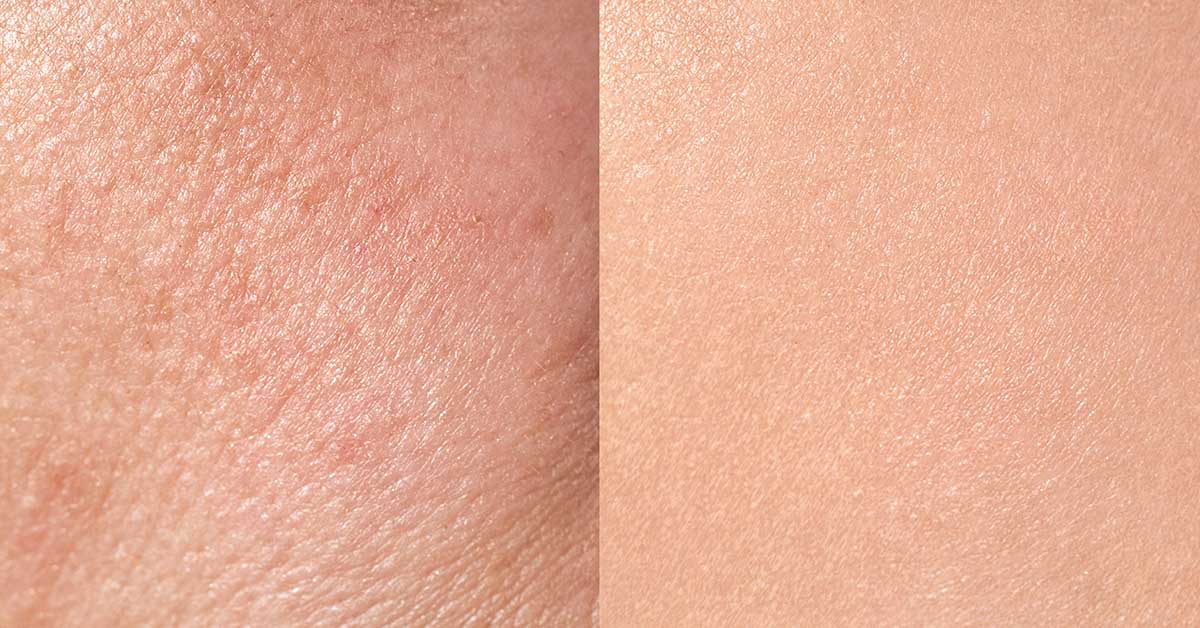 Scientists ‘Reverse Aging’ in 53-Year-Old Woman’s Skin Cells by 30 Years