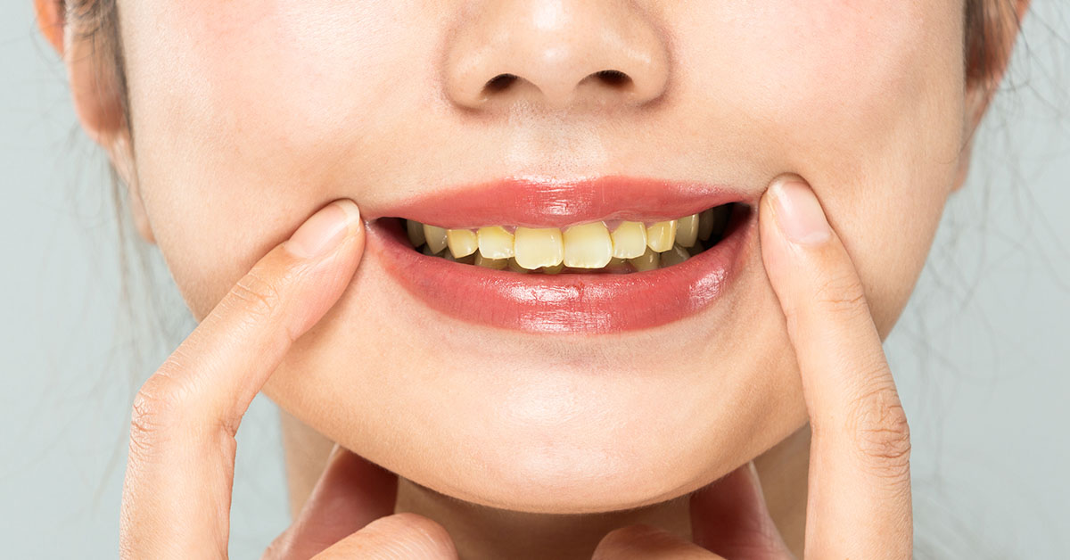 Dentist Reveals Two Common Brushing Mistakes That Can Cause Yellow Teeth