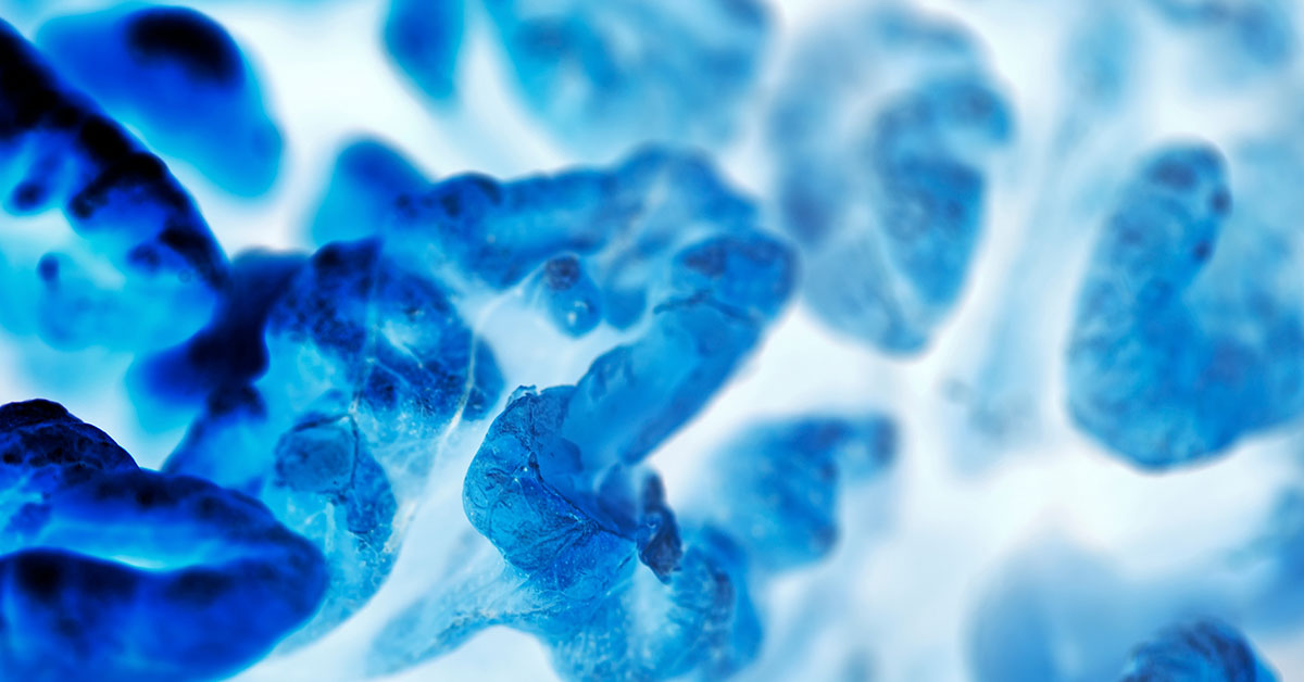 New Study Identifies Protein That Keeps Cancer Cells in Dormant State