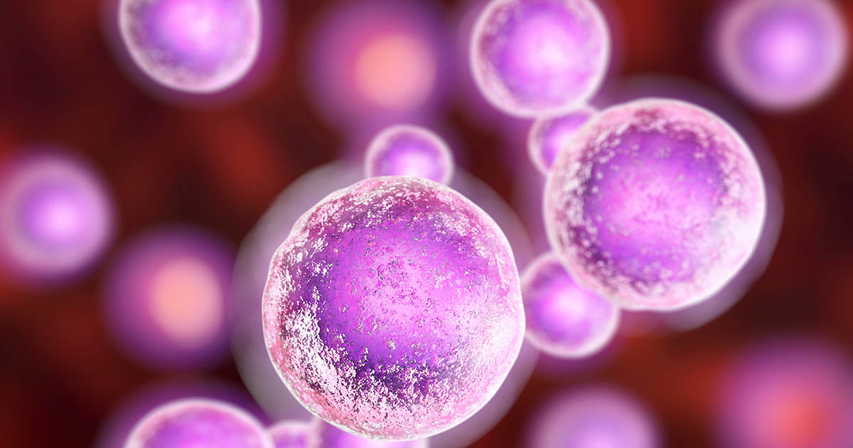 Child Who Underwent CAR-T Cancer Therapy Remains Disease-Free After 18 Years