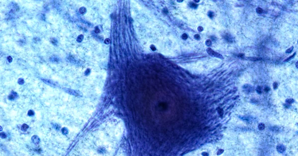In A World First, Scientists Create Computer That Runs On Living Human Brain Cells