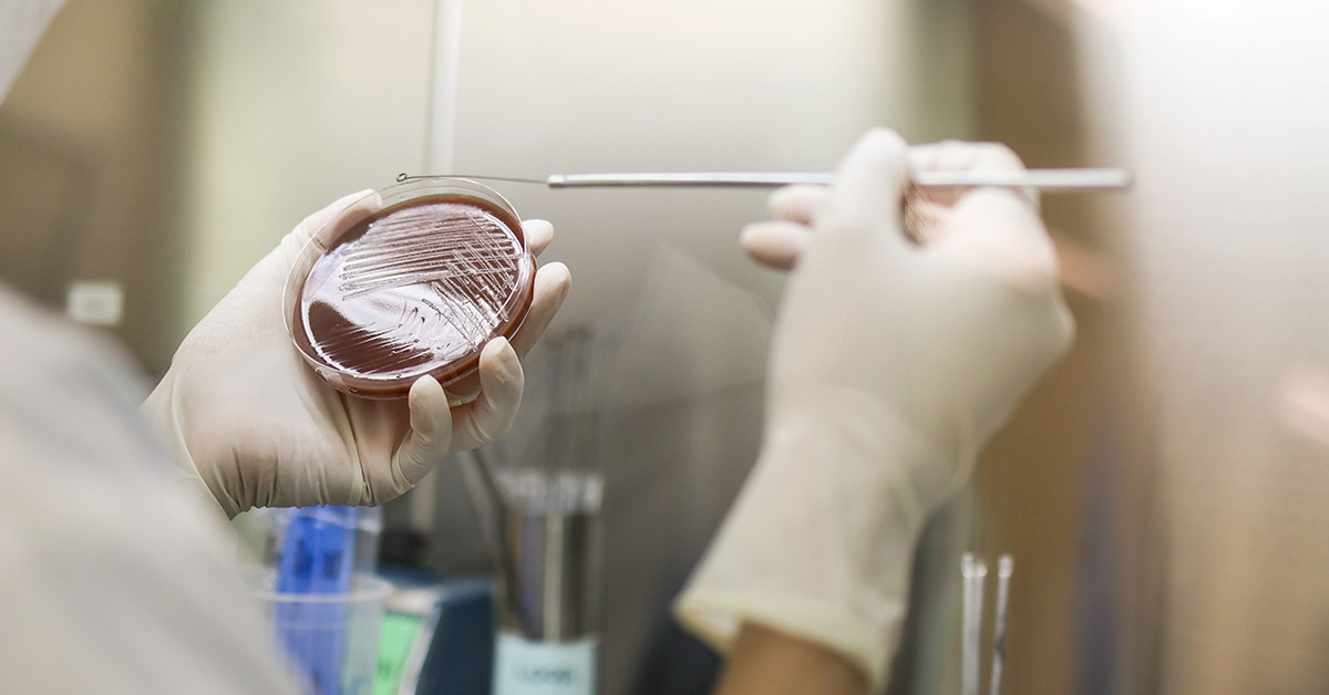 New Sexually Transmitted Infection: Doctors Warn It May Already Affect Millions