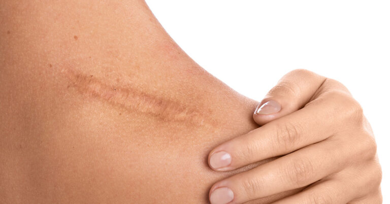 Scientists Develop Gel That Self-Heals Similar to Human Skin - Featured image