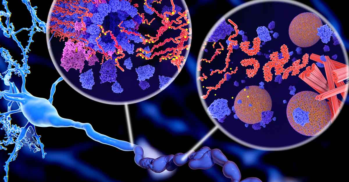 How New Research Is Targeting Toxic Tau Protein in Alzheimer’s Disease