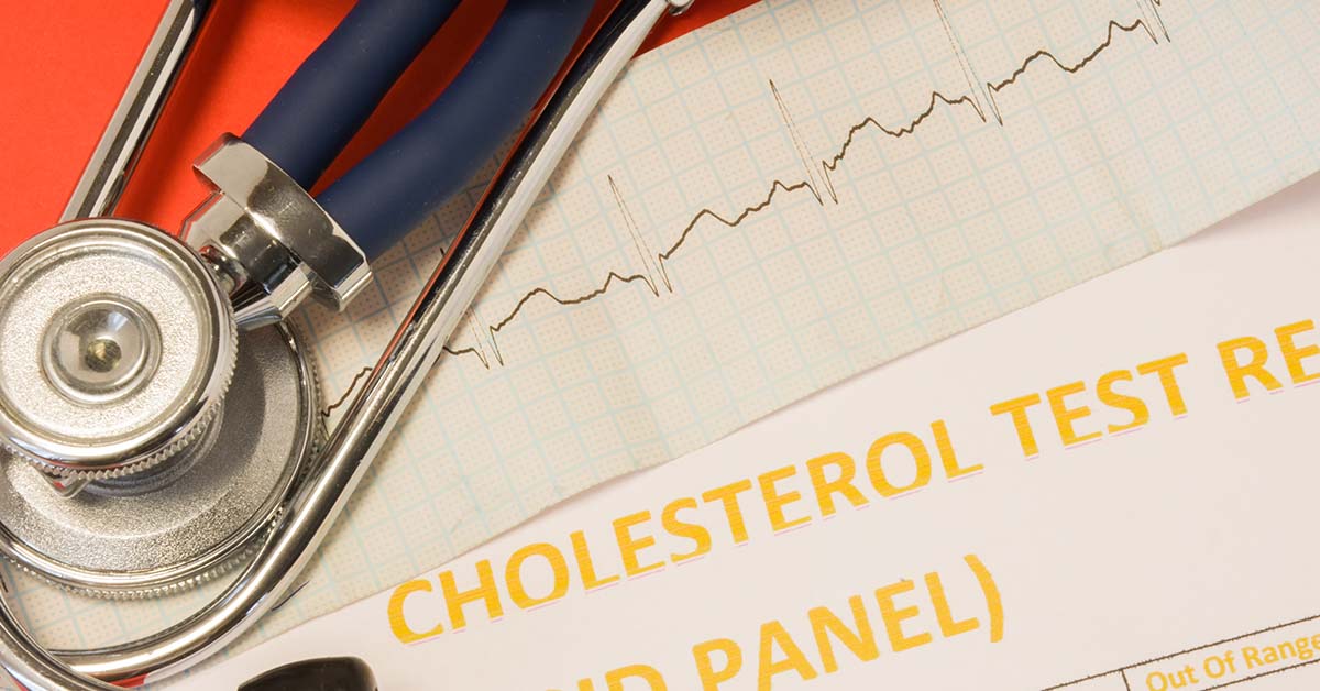 4 Simple Lifestyle Changes  More Effective Than Statins for Cholesterol, Doctor Claims