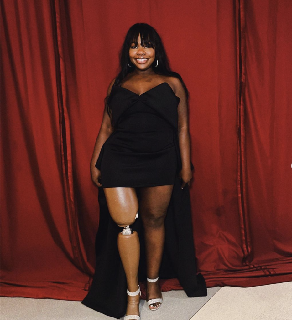 Singer, songwriter, and bionic model Marsha Elle showing her prosthetic leg