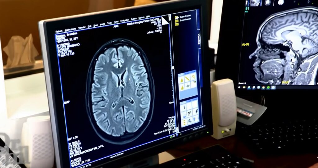 brain scan
