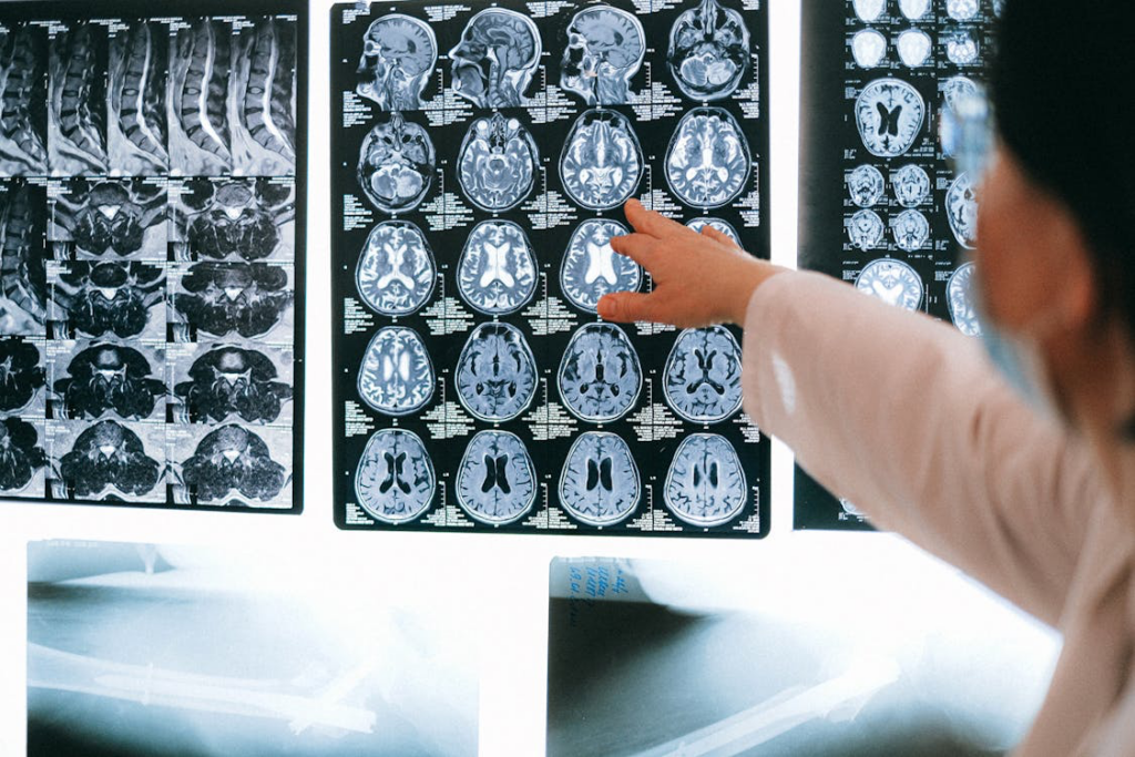 A woman doctor points at an MRI scan, highlighting key findings related to dementia risk factors identified by scientists.