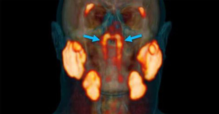 Scientists May Have Accidentally Discovered New Organ Inside The Human Head - Featured image