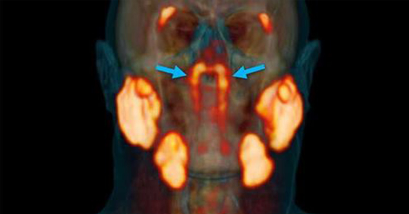 Scientists May Have Accidentally Discovered New Organ Inside The Human Head