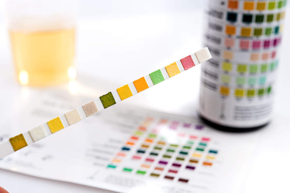 Test tires with test chart and urine can
