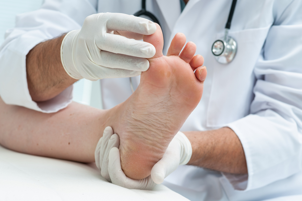 Doctor dermatologist examines the foot on the presence of athlete's foot