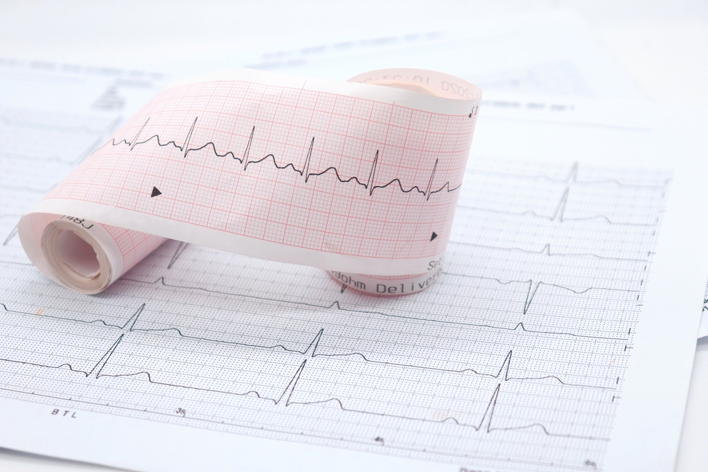 heart rhythm ekg note on paper Doctors use it to analyze heart disease treatments. illustration on a white background