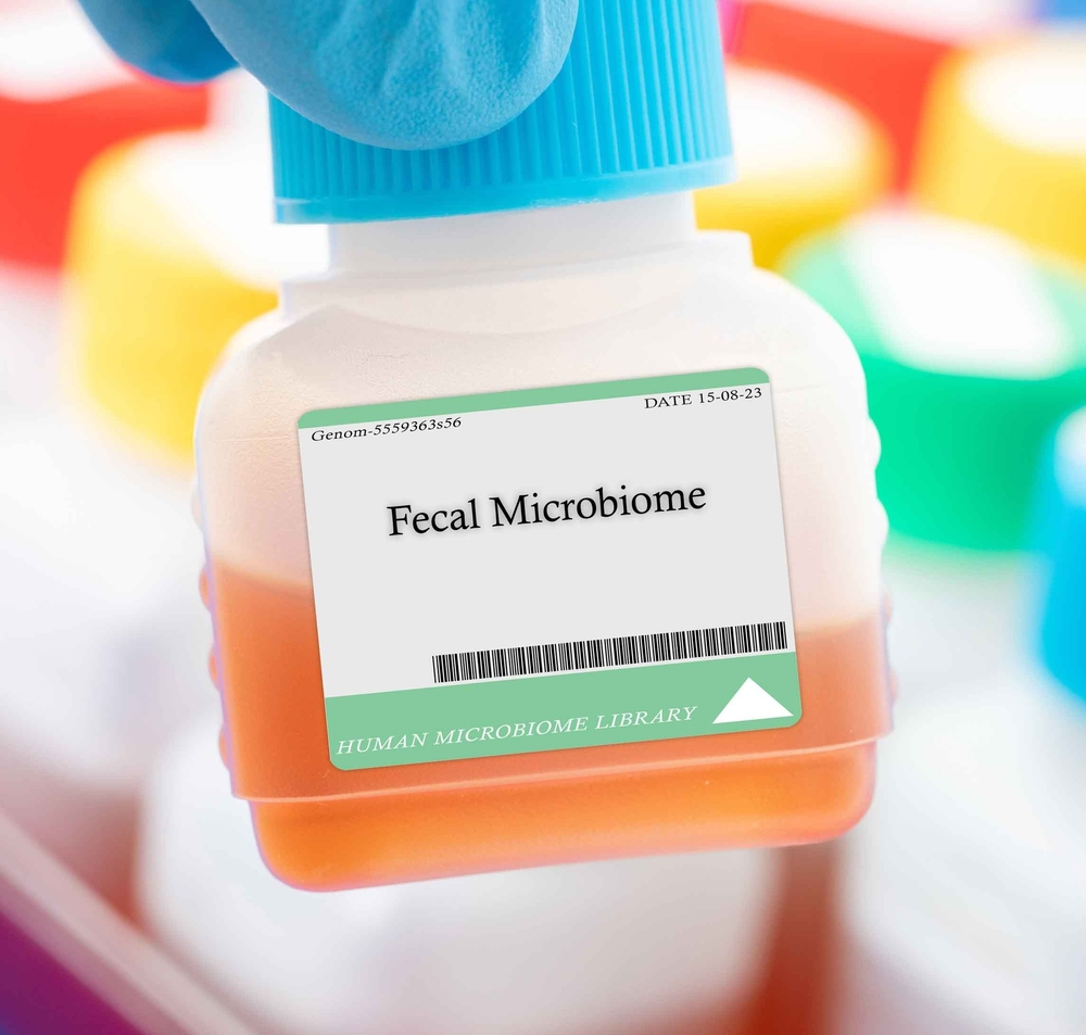 Fecal microbiota transplant (FMT), also known as a stool transplant, is the process of transferring fecal bacteria and other microbes from a healthy individual into another
