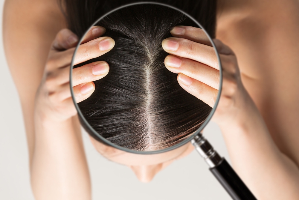 Enlarge a woman's scalp with a magnifying glass.