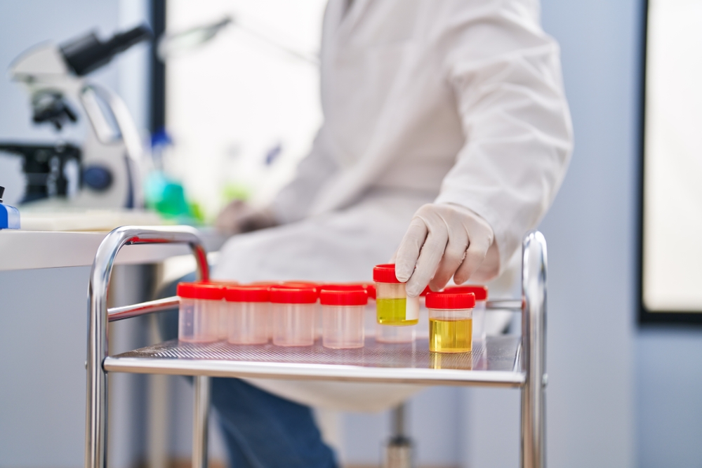 Young hispanic man scientist holding urine test tube at laboratory