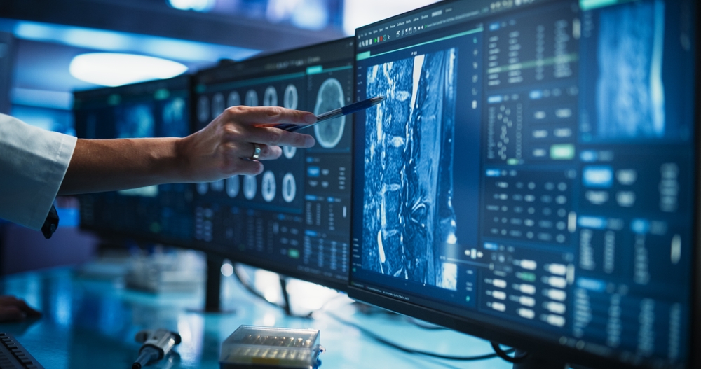 Modern Cancer Research Medical Center: Anonymous Doctor Pointing At Desktop Computer Monitor With 3D Software Visualizing Human Brain Based On CT Scan. Neurologist Looking For Tumor In Patient's Brain