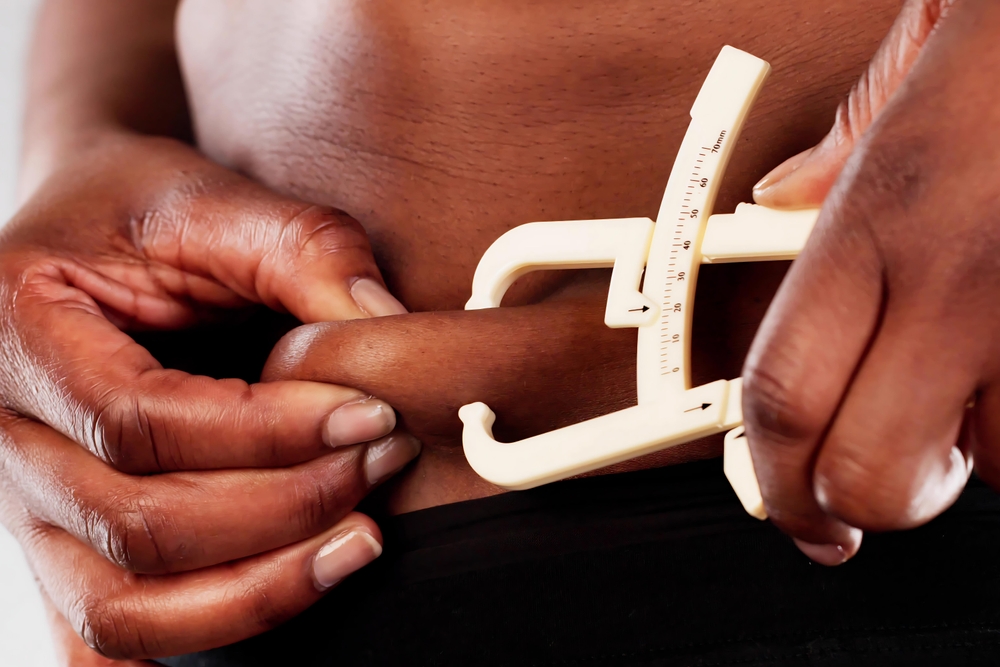 African woman using a fat caliper to measure belly fat, focusing on bariatric weight loss and obesity in black community.
