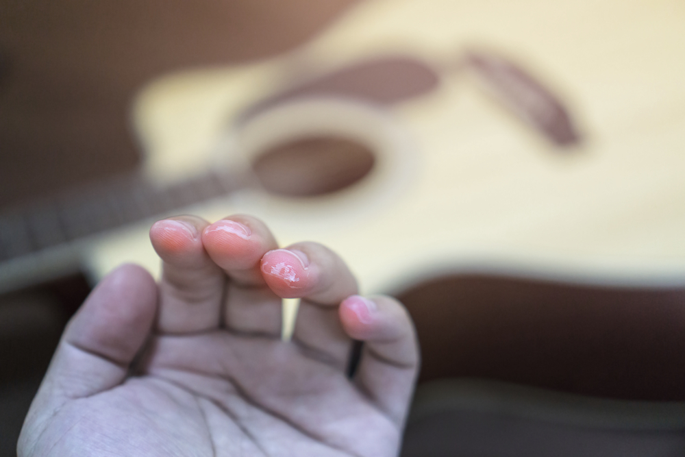 sore fingers by play guitar