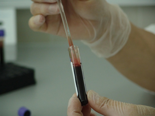 blood vial sample