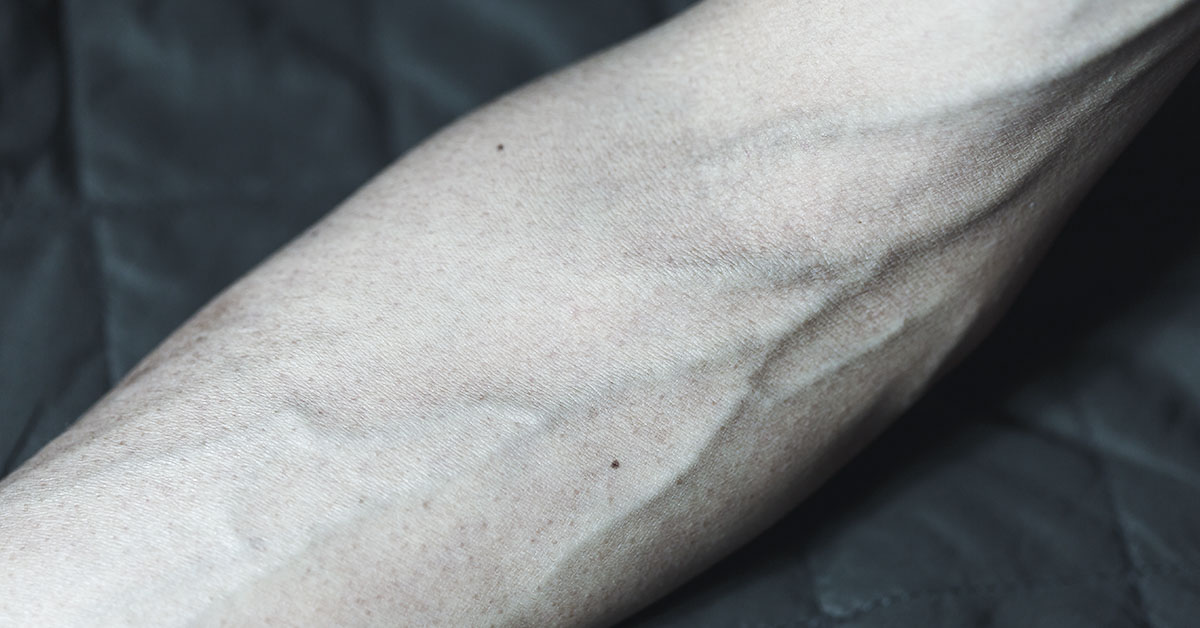 Lifelike Humanoid Robot with Muscles and Bones Awakens for the First Time
