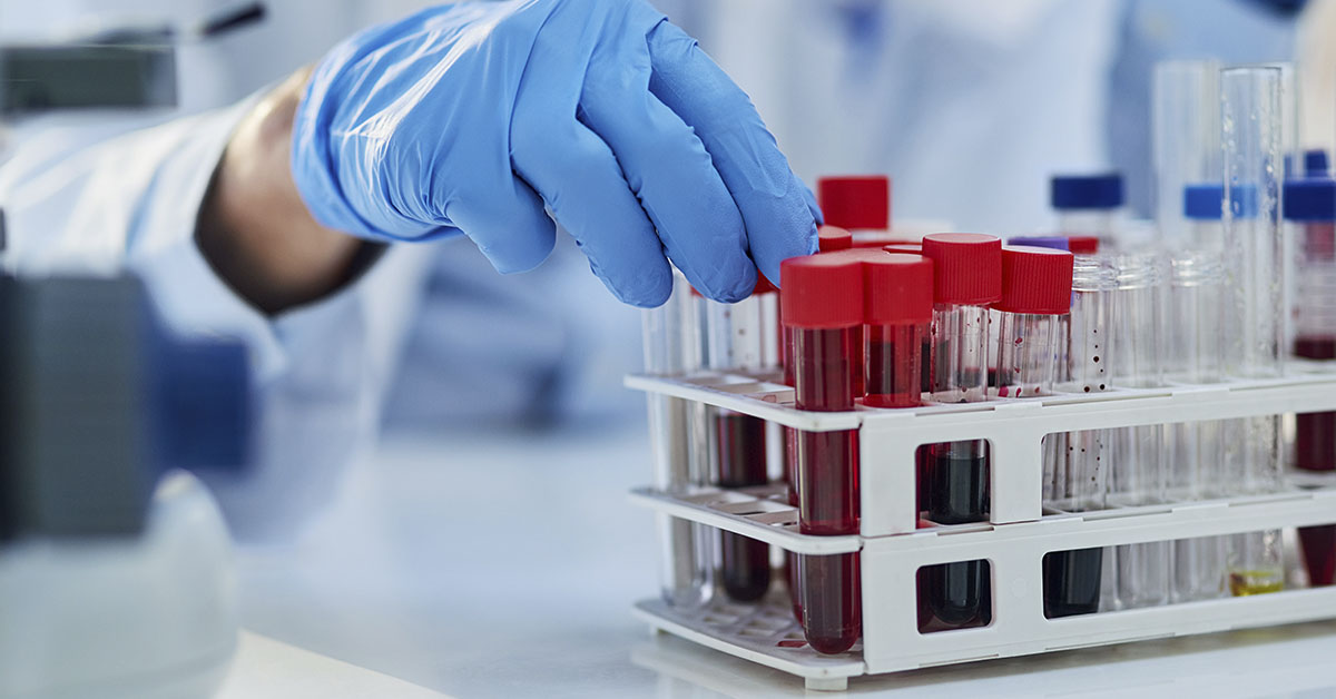 Decades-Long Mystery Solved: Scientists Discover New MAL Blood Group