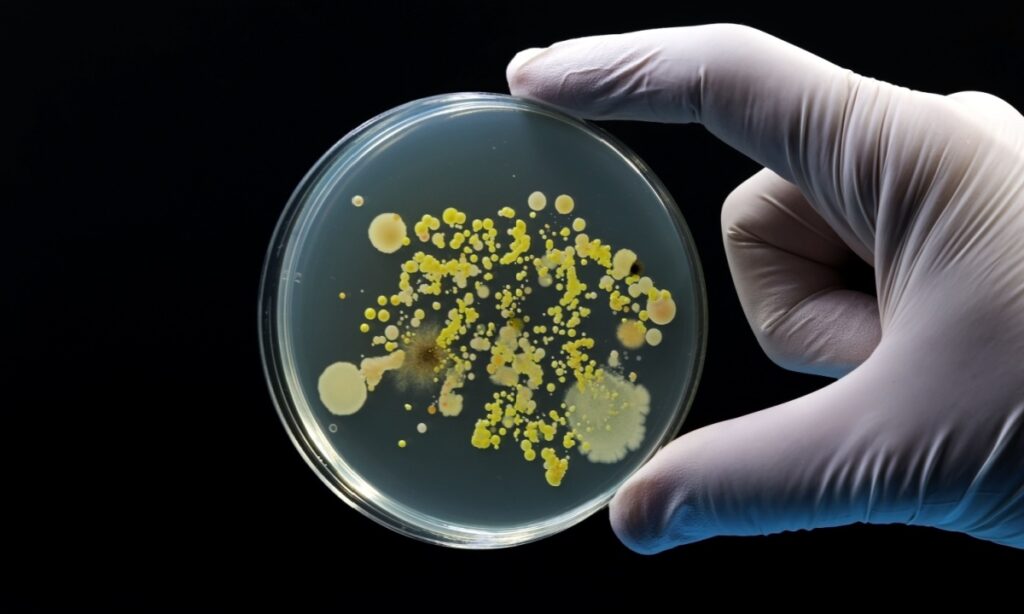 petri dish with bacteria