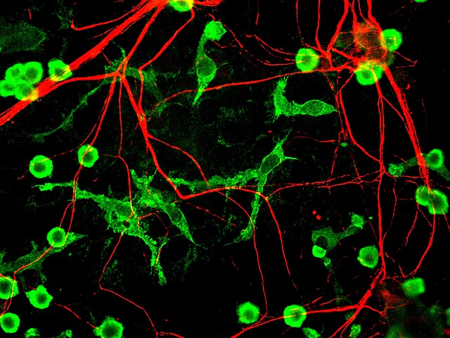 Close-up picture of rat brain cells under a special microscope. The green spots are brain immune cells called microglia. The red lines are parts of nerve cells. This colorful image shows how these brain cells connect and work together. The bright colors stand out against the black background, making it easy to see how these cells live side by side in the brain.