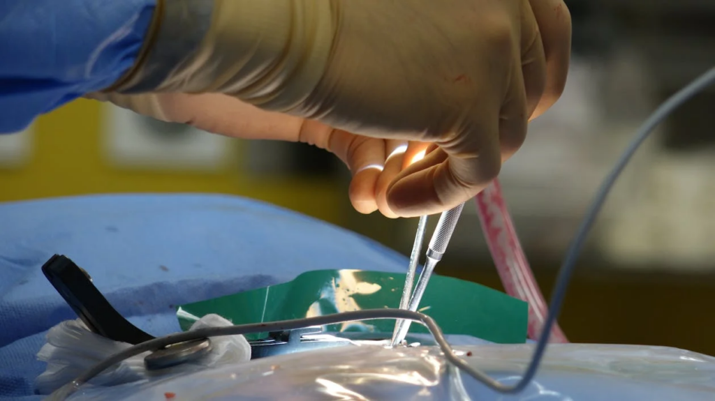 Surgeon Performing Delicate Surgery in Operating Room
