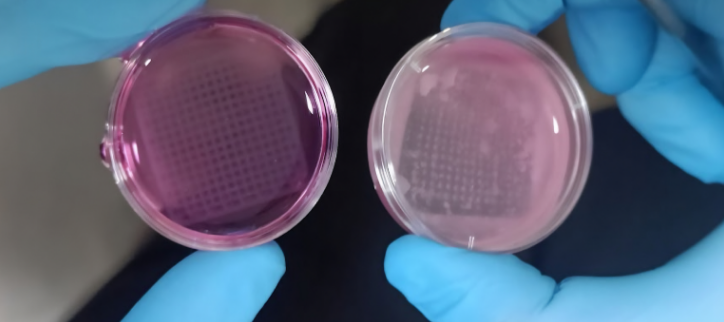 the 3d_printed skin