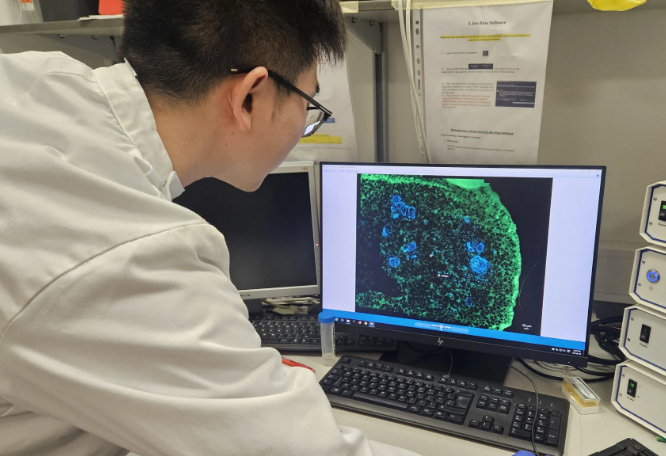 Xuechen Zhang  explores lab-grown teeth