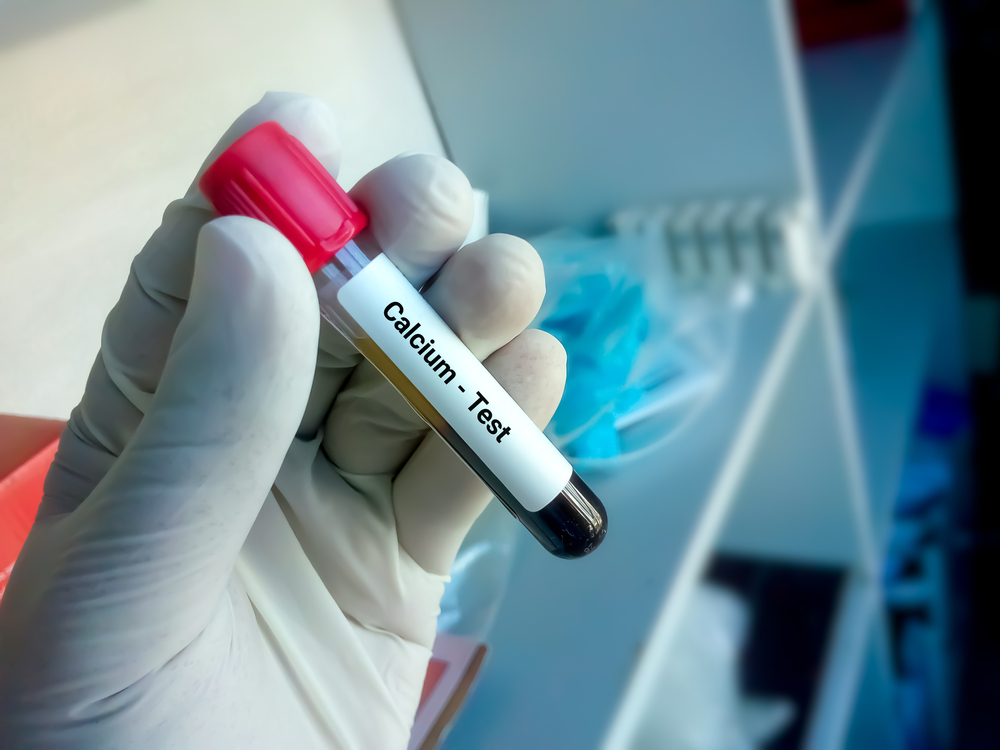 Blood sample for calcium test