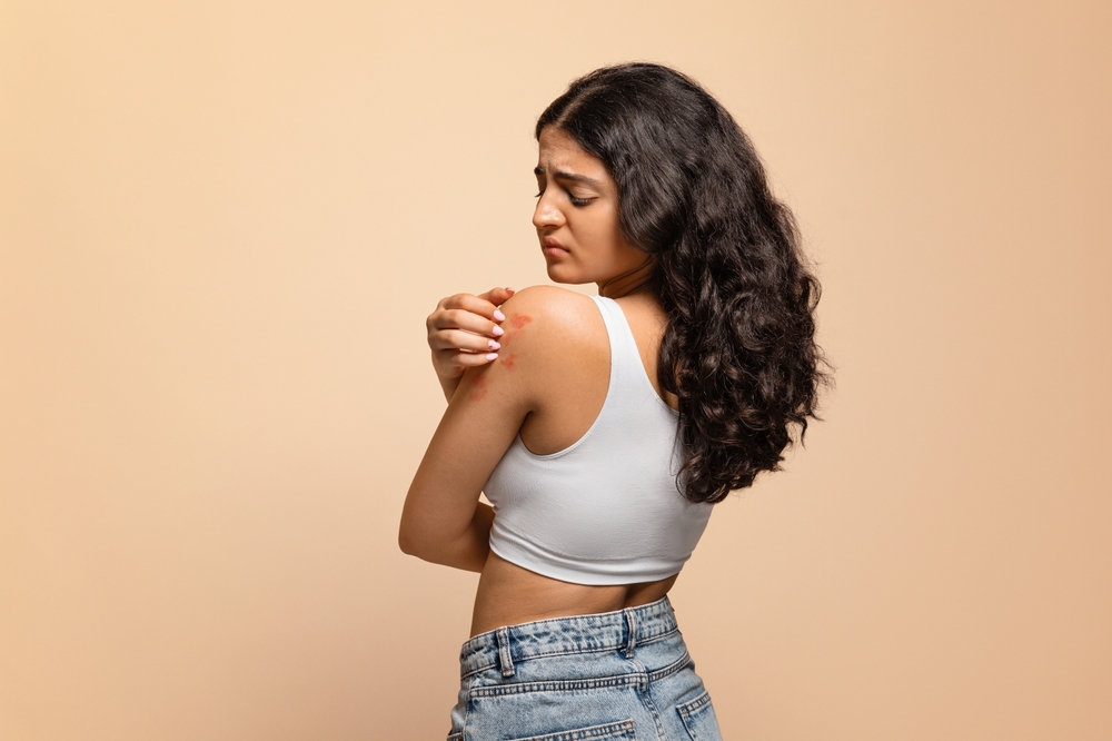 Annoyed young indian woman scratching her irritated body skin, upset eastern female suffering psoriasis, eczema or dermatitis, having itching rash on epidermis, standing on beige studio background