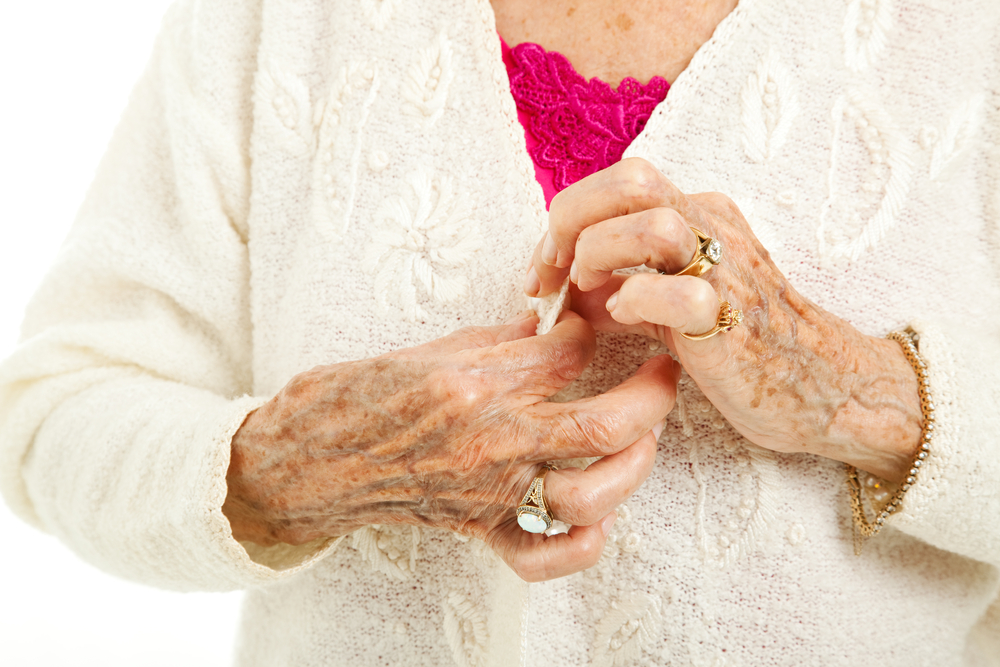 Senior woman's arthritic hands struggling to button her sweater.
