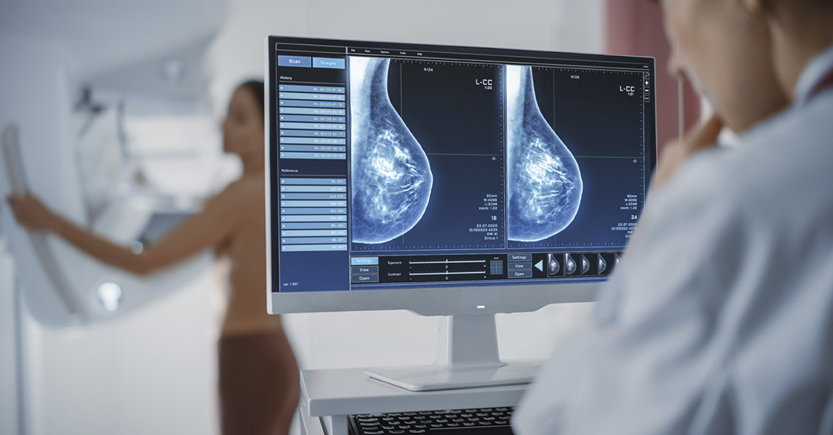 Mammograms: Navigating the Risks, Benefits, and Misinformation