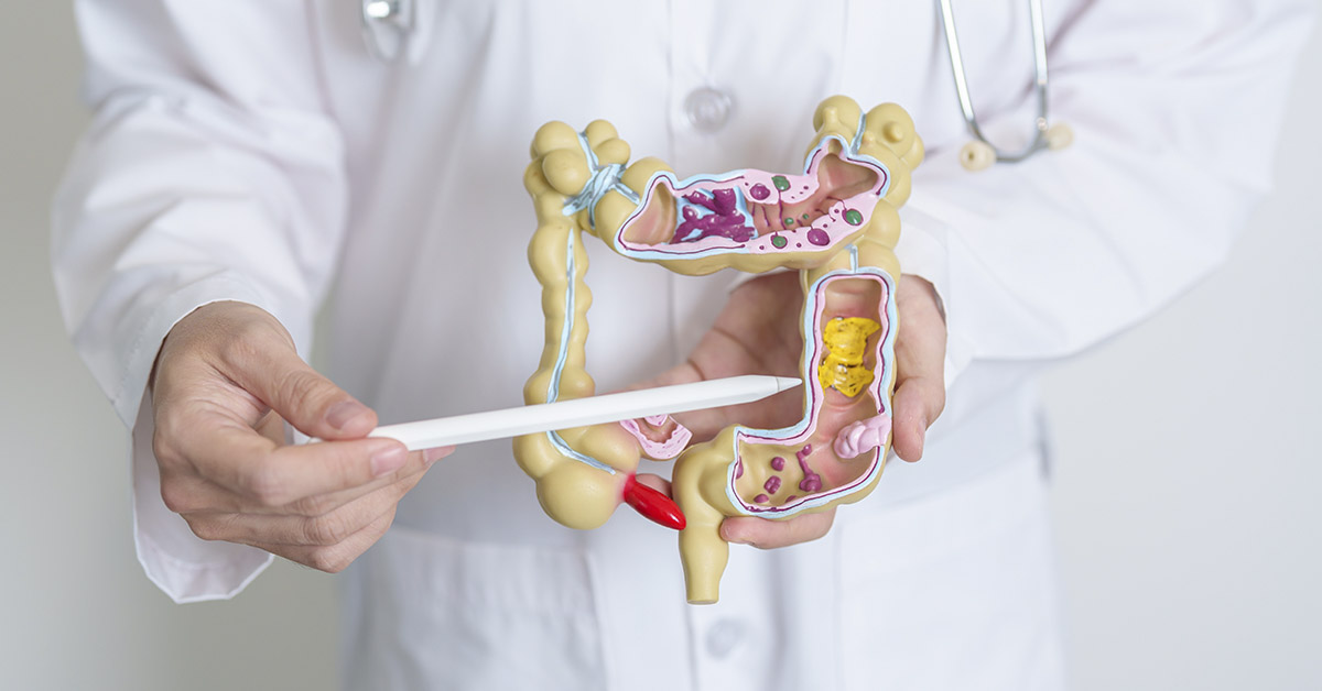 Against the Odds: Terminal Colon Cancer Patient Recovers After Experimental Therapy