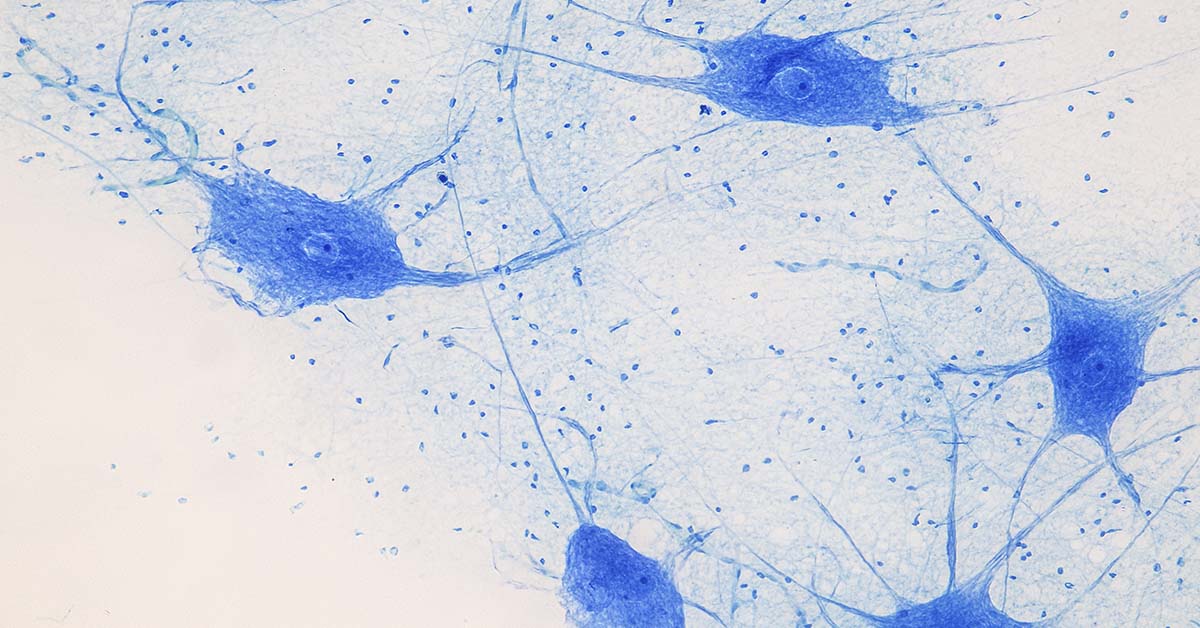 Dead for Four Years, This Composer Is Releasing New Music—Thanks to a Lab-Grown Brain