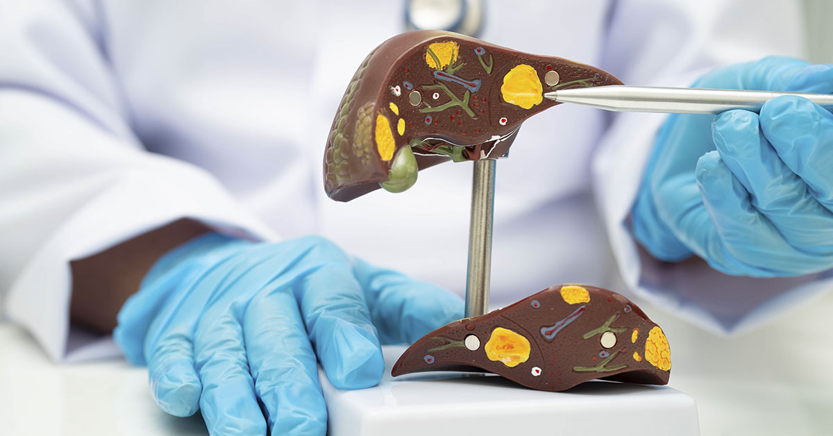 Drug That Elevates NAD+ Offers New Hope for Fatty Liver Disease