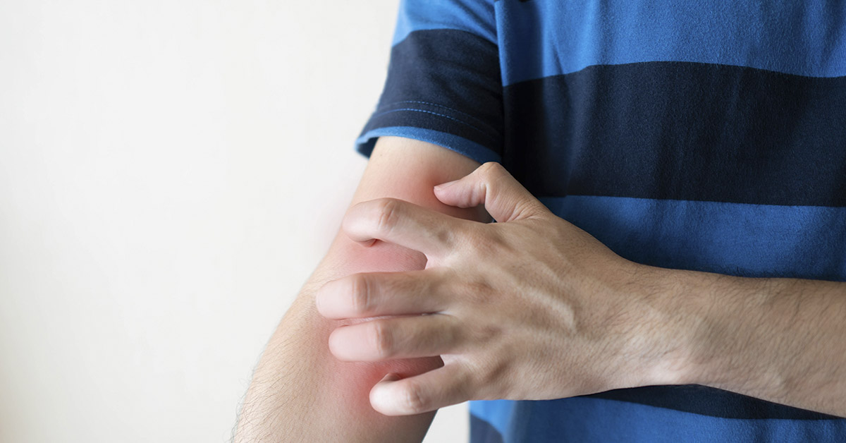 Itchy Red Spots on Your Skin? Don’t Ignore This Common but Misunderstood Condition