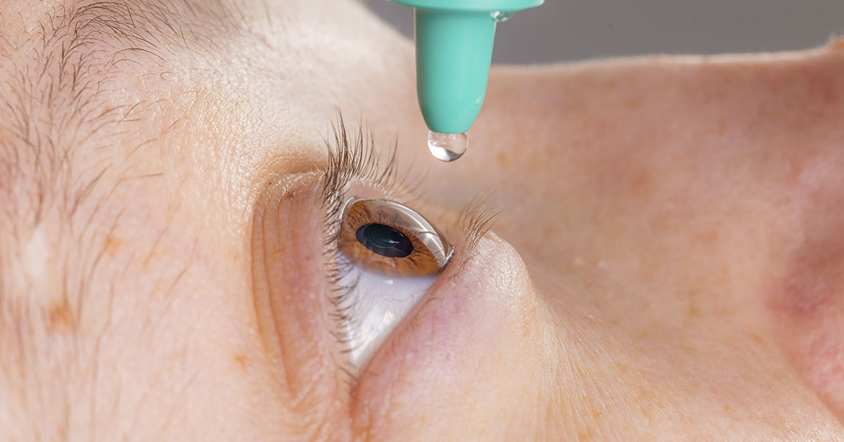 Over-the-Counter Eye Drops Recalled: Check The Full List