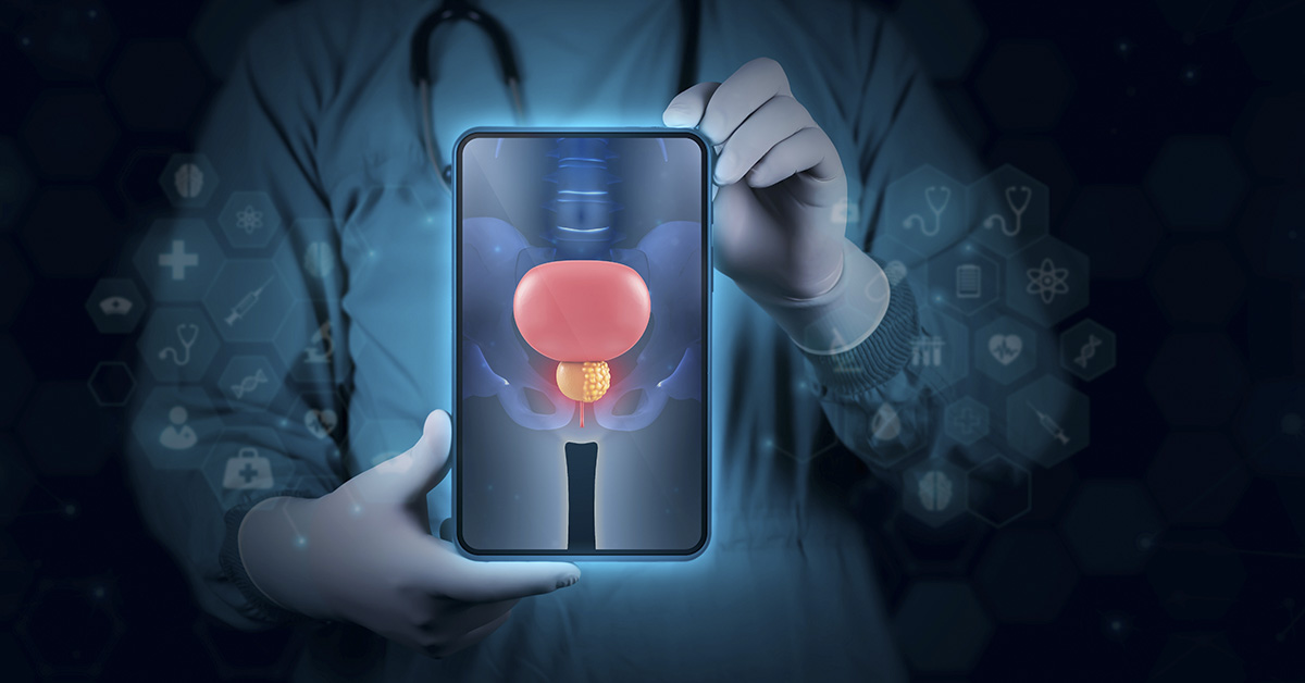 5 Prostate Cancer Symptoms Every Man Should Watch For