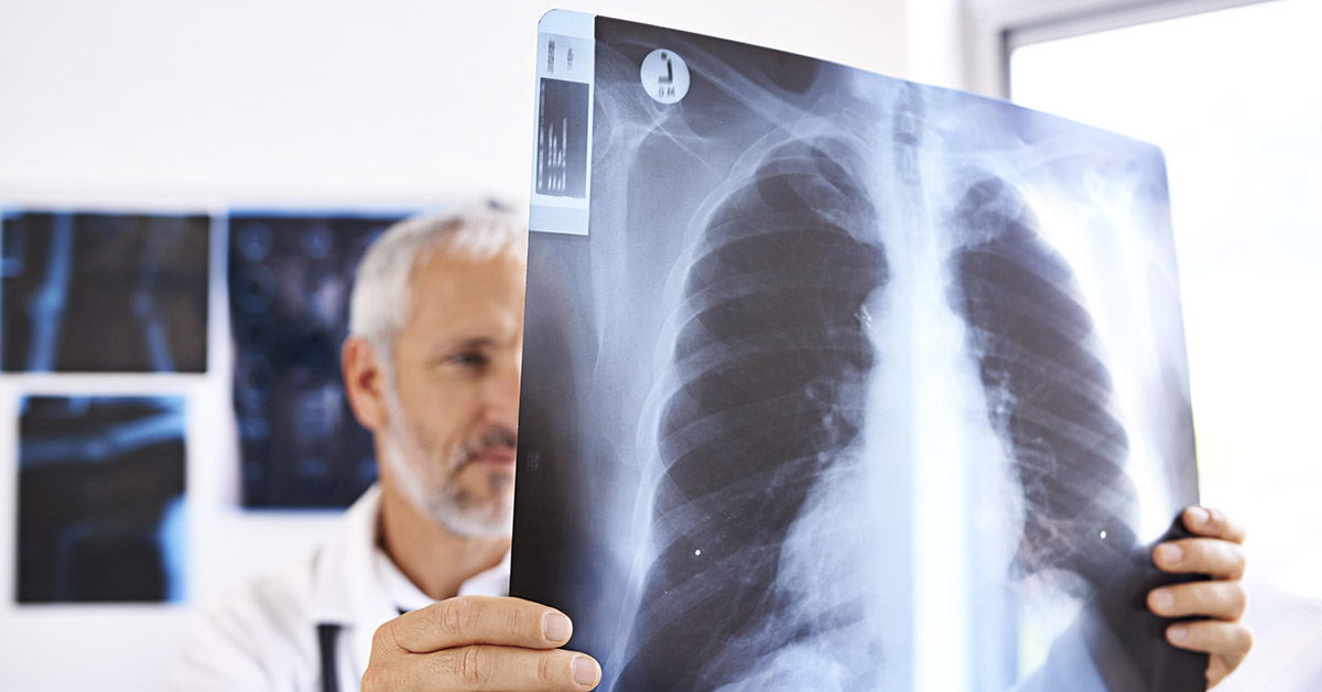 The Surprising Role of Lungs in Blood Formation