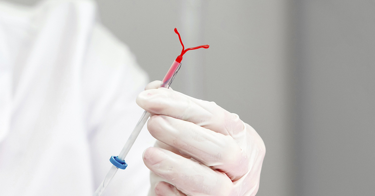 Updated Guidelines Urge Doctors to Address Pain During IUD Insertion