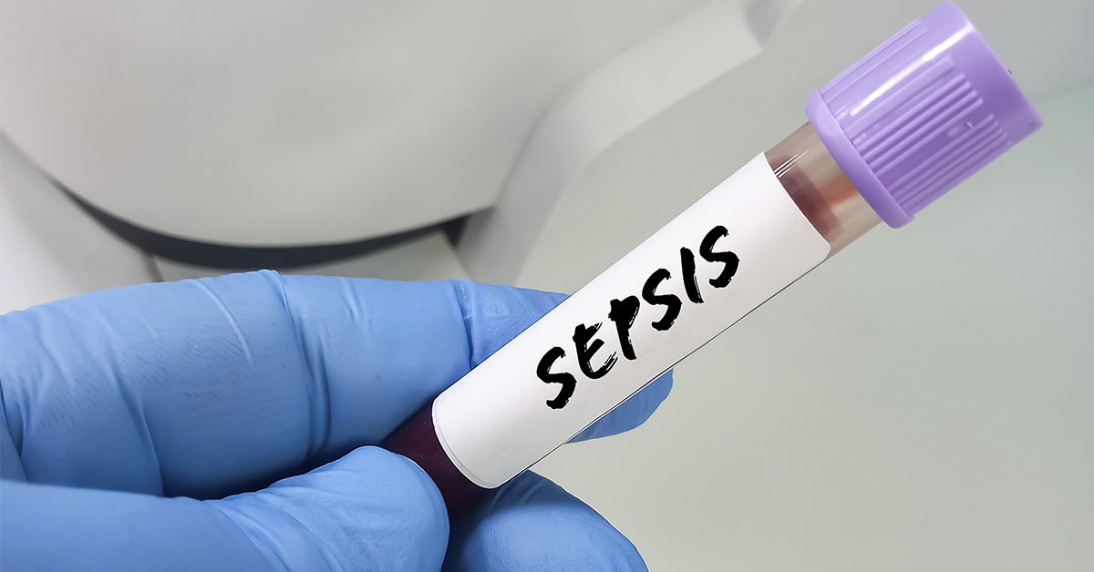 What Makes Sepsis One of the Deadliest Conditions?