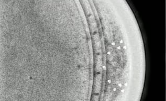 X-ray of the object