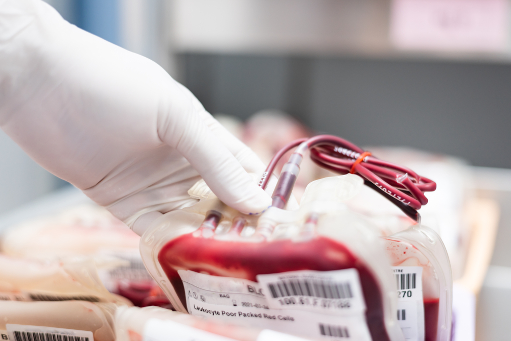 Close up scientist hand holding red blood bag in storage blood refrigerator at blood bank unit laboratory.Save life and medical treatment concept.
