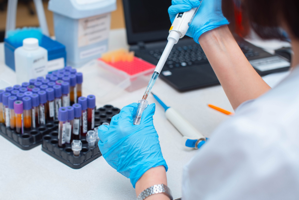 Blood test in the laboratory. Laboratory assistant working with the dispenser. Vacuum tubes with blood.
