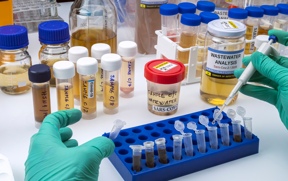 Investigation of sars-cov-2 virus in humans in a wastewater laboratory, conceptual image
