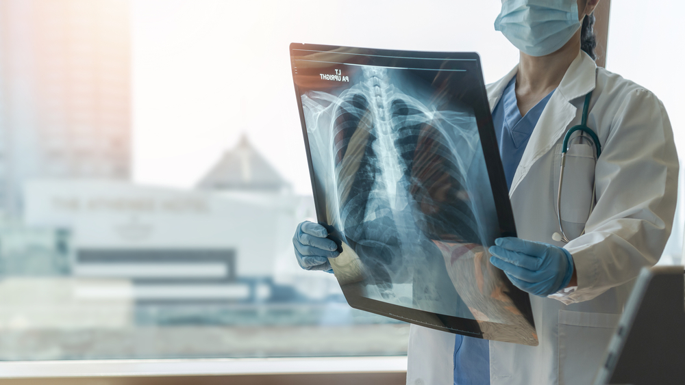 Lung disease, covid-19, asthma or bone cancer illness with doctor diagnosing patient’s health on radiological chest x-ray film for medical healthcare hospital service
